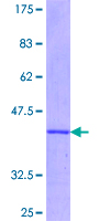 12.5% SDS-PAGE Stained with Coomassie Blue